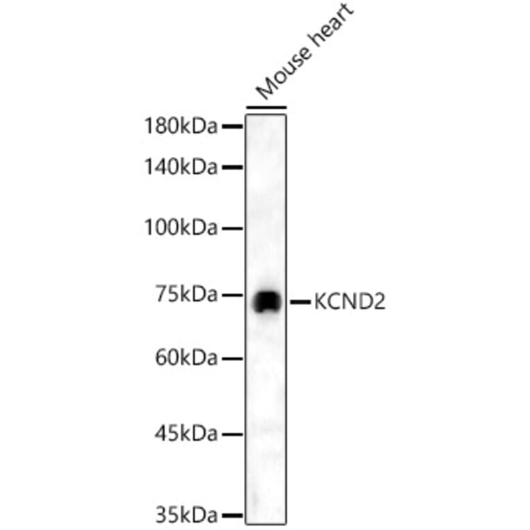 Western Blot - Anti-Kv4.2/KCND2 Antibody (A15103) - Antibodies.com