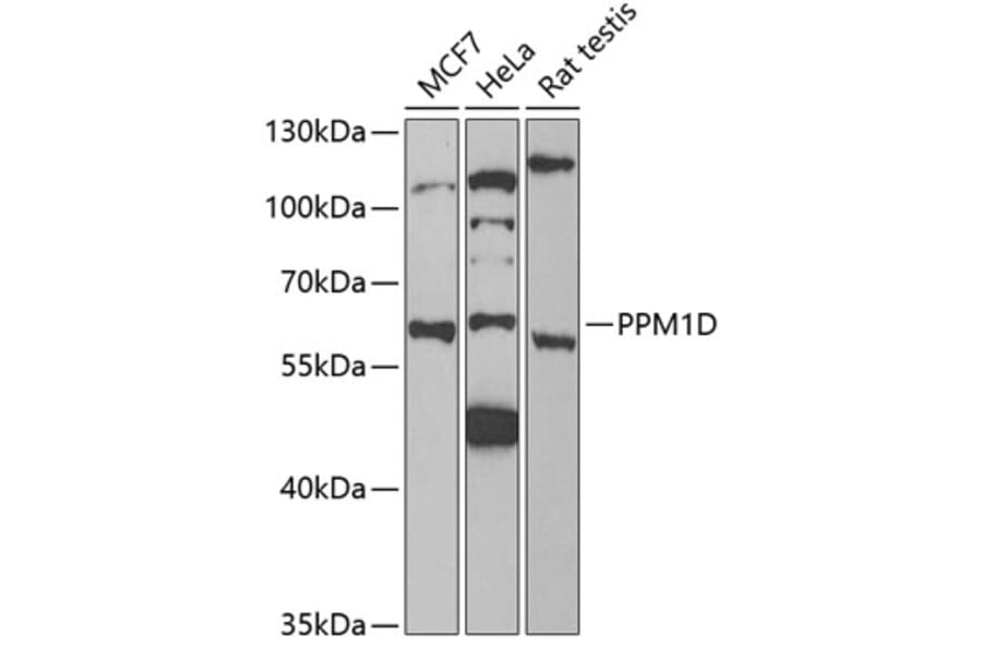 Western Blot - Anti-PPM1D/WIP1 Antibody (A15104) - Antibodies.com