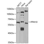 Western Blot - Anti-PPM1D/WIP1 Antibody (A15104) - Antibodies.com