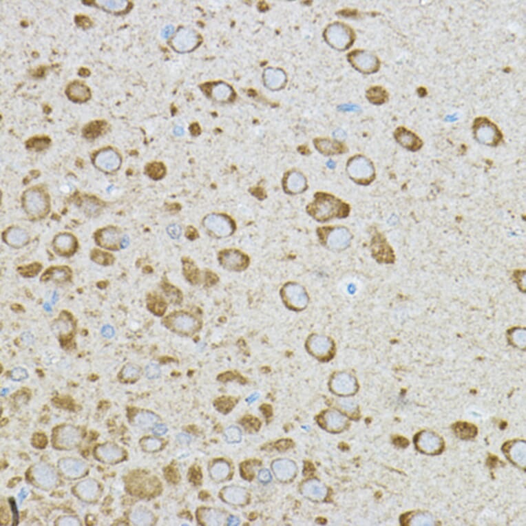 Immunohistochemistry - Anti-IRAK4 Antibody (A15105) - Antibodies.com