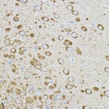 Immunohistochemistry - Anti-IRAK4 Antibody (A15105) - Antibodies.com