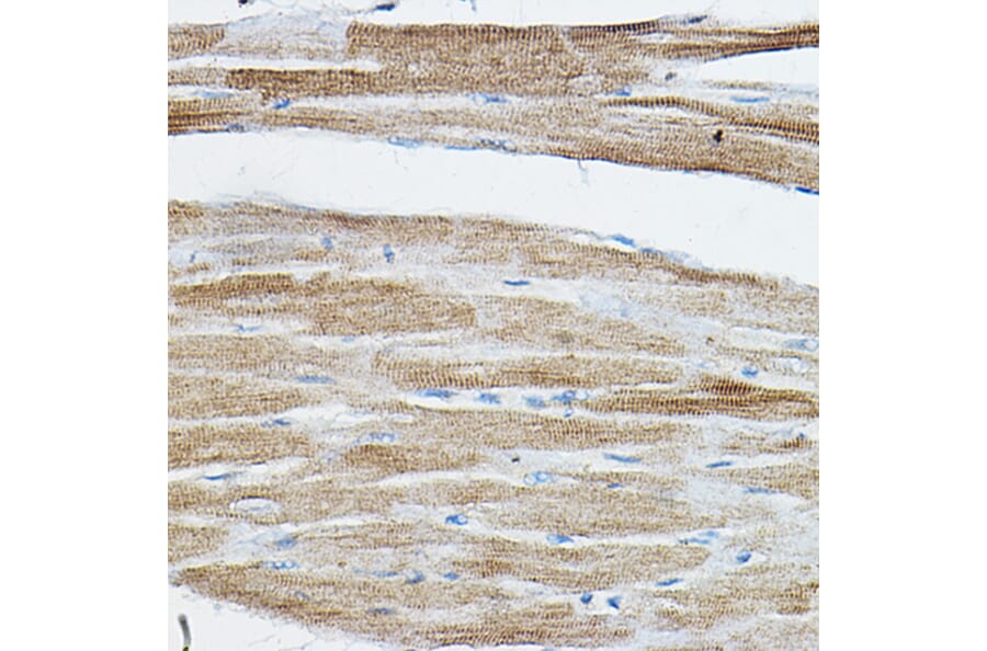 Immunohistochemistry - Anti-IRAK4 Antibody (A15105) - Antibodies.com