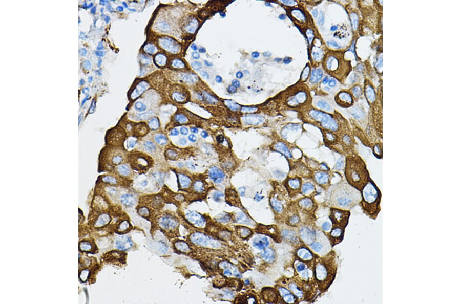 Immunohistochemistry - Anti-IRAK4 Antibody (A15105) - Antibodies.com