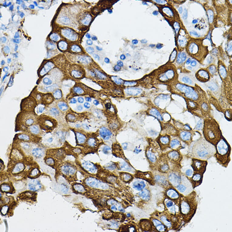 Immunohistochemistry - Anti-IRAK4 Antibody (A15105) - Antibodies.com