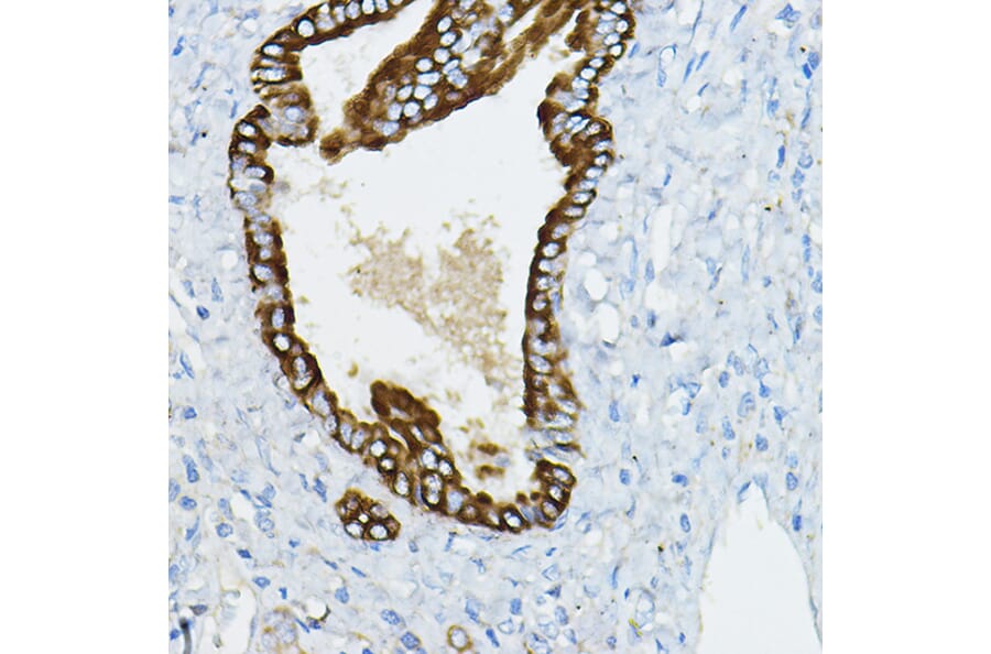 Immunohistochemistry - Anti-IRAK4 Antibody (A15105) - Antibodies.com