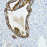 Immunohistochemistry - Anti-IRAK4 Antibody (A15105) - Antibodies.com