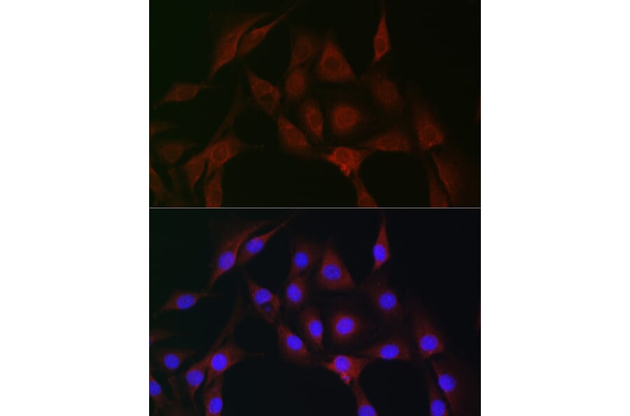 Immunofluorescence - Anti-IRAK4 Antibody (A15105) - Antibodies.com