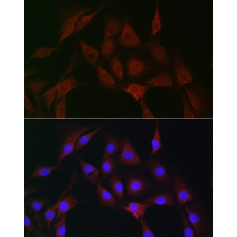 Immunofluorescence - Anti-IRAK4 Antibody (A15105) - Antibodies.com