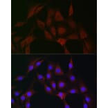 Immunofluorescence - Anti-IRAK4 Antibody (A15105) - Antibodies.com