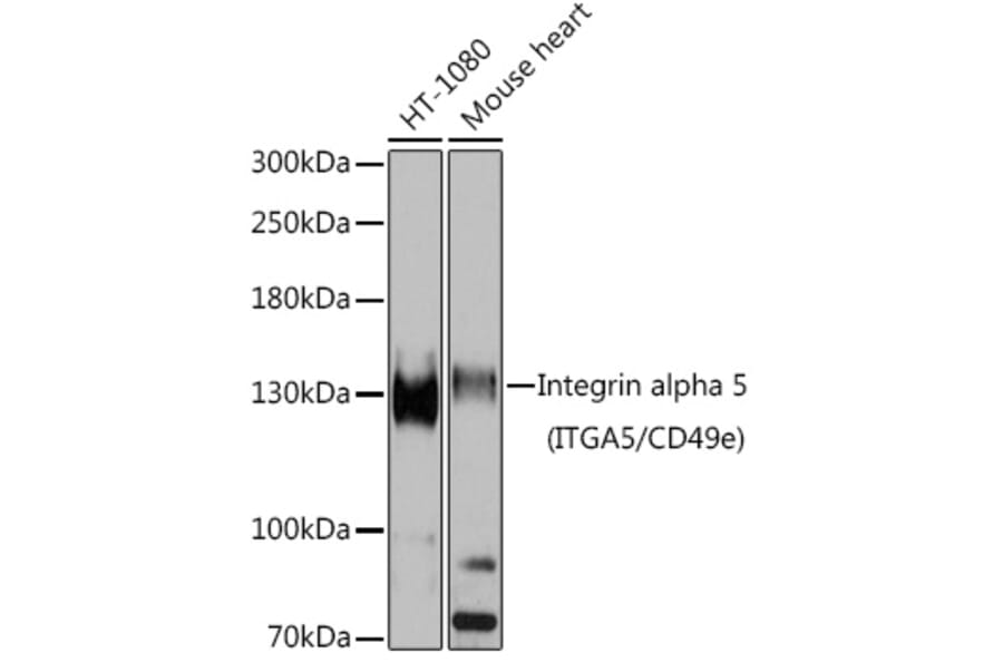 Western Blot - Anti-Integrin alpha 5 Antibody (A15106) - Antibodies.com