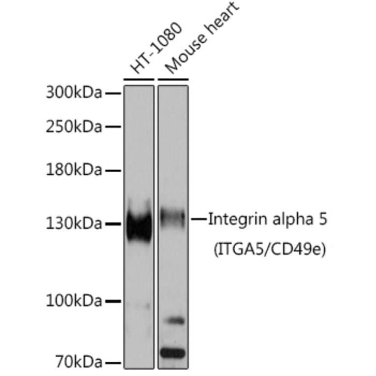Western Blot - Anti-Integrin alpha 5 Antibody (A15106) - Antibodies.com