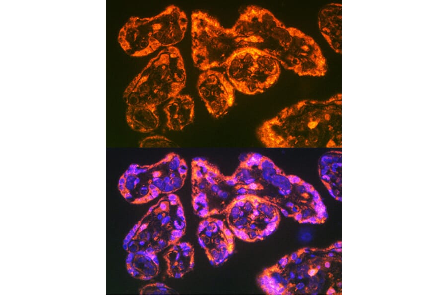 Immunofluorescence - Anti-Integrin alpha 5 Antibody (A15106) - Antibodies.com