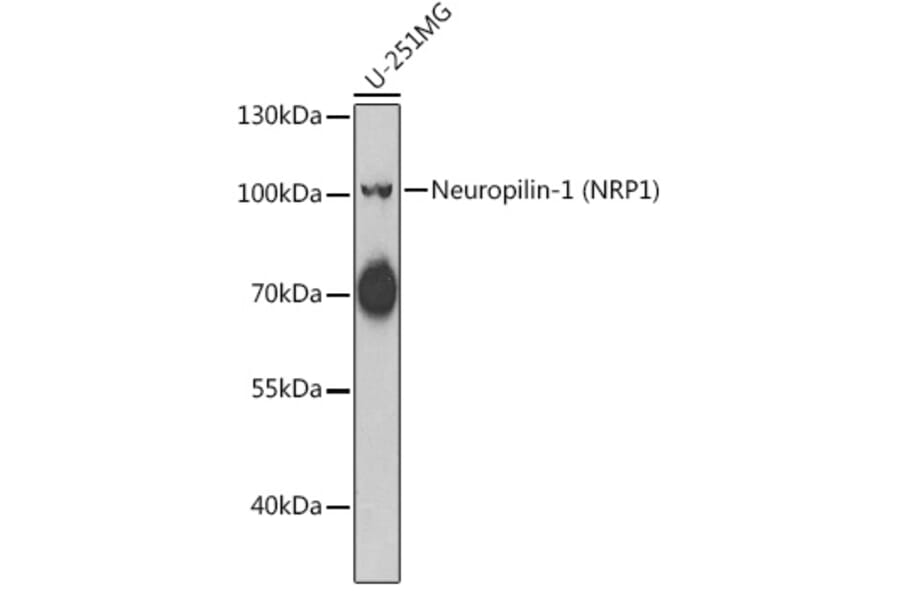 Western Blot - Anti-Neuropilin 1 Antibody (A15107) - Antibodies.com