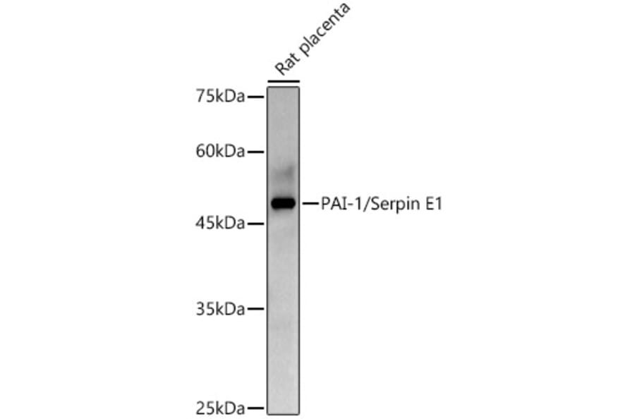 Western Blot - Anti-PAI1 Antibody (A15108) - Antibodies.com