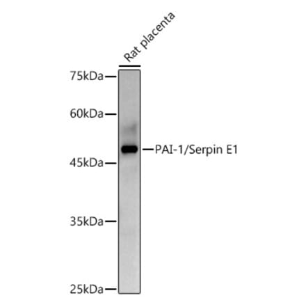 Western Blot - Anti-PAI1 Antibody (A15108) - Antibodies.com