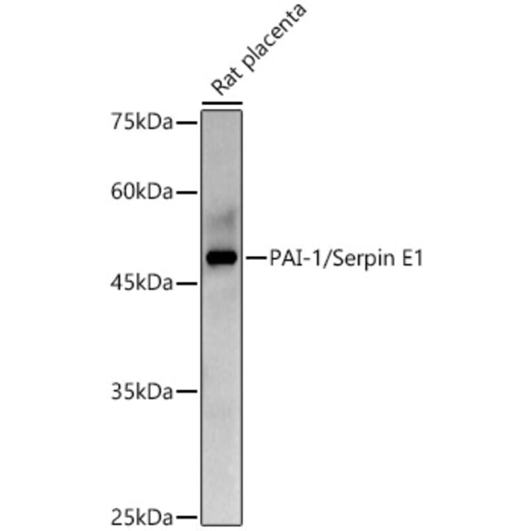 Western Blot - Anti-PAI1 Antibody (A15108) - Antibodies.com