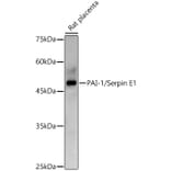 Western Blot - Anti-PAI1 Antibody (A15108) - Antibodies.com
