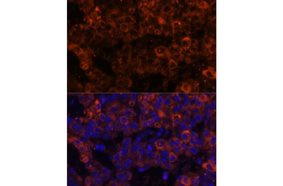 Immunofluorescence - Anti-PAI1 Antibody (A15108) - Antibodies.com