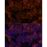 Immunofluorescence - Anti-PAI1 Antibody (A15108) - Antibodies.com