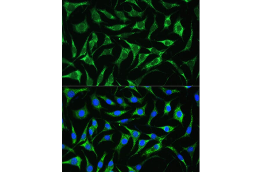 Immunofluorescence - Anti-PAI1 Antibody (A15108) - Antibodies.com