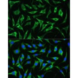 Immunofluorescence - Anti-PAI1 Antibody (A15108) - Antibodies.com