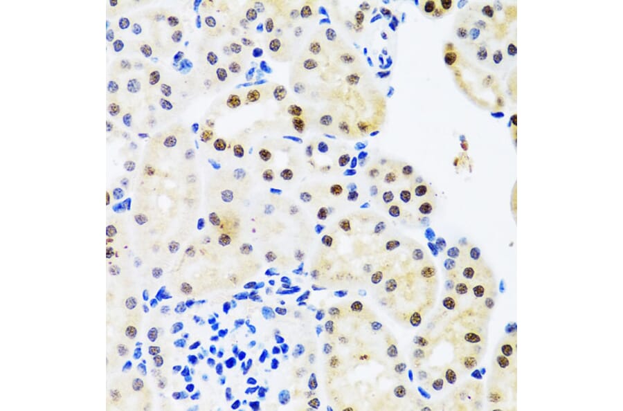 Immunohistochemistry - Anti-SET/TAF-I Antibody (A15109) - Antibodies.com