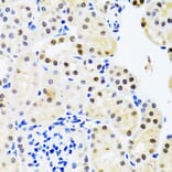 Immunohistochemistry - Anti-SET/TAF-I Antibody (A15109) - Antibodies.com