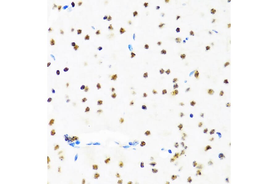 Immunohistochemistry - Anti-SET/TAF-I Antibody (A15109) - Antibodies.com
