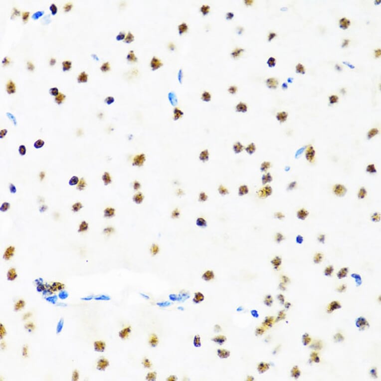 Immunohistochemistry - Anti-SET/TAF-I Antibody (A15109) - Antibodies.com