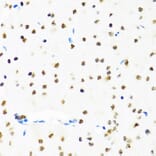 Immunohistochemistry - Anti-SET/TAF-I Antibody (A15109) - Antibodies.com