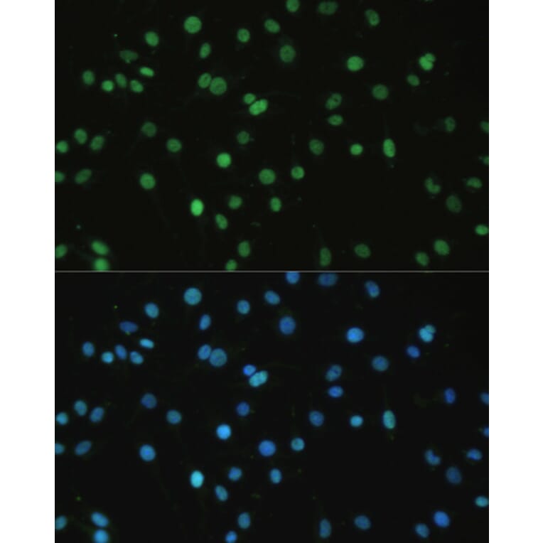 Immunofluorescence - Anti-SET/TAF-I Antibody (A15109) - Antibodies.com