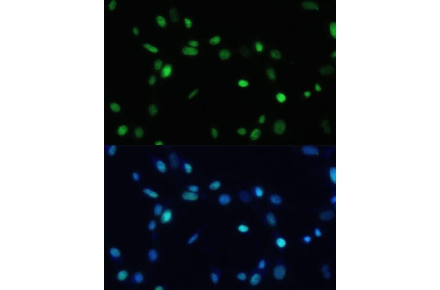 Immunofluorescence - Anti-SET/TAF-I Antibody (A15109) - Antibodies.com