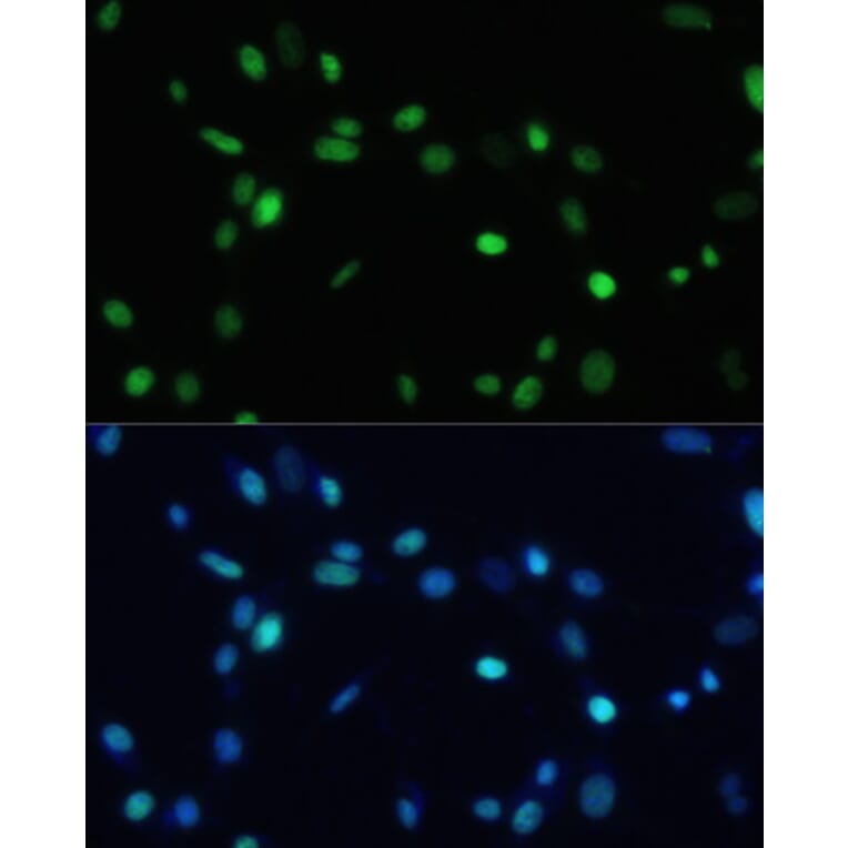 Immunofluorescence - Anti-SET/TAF-I Antibody (A15109) - Antibodies.com