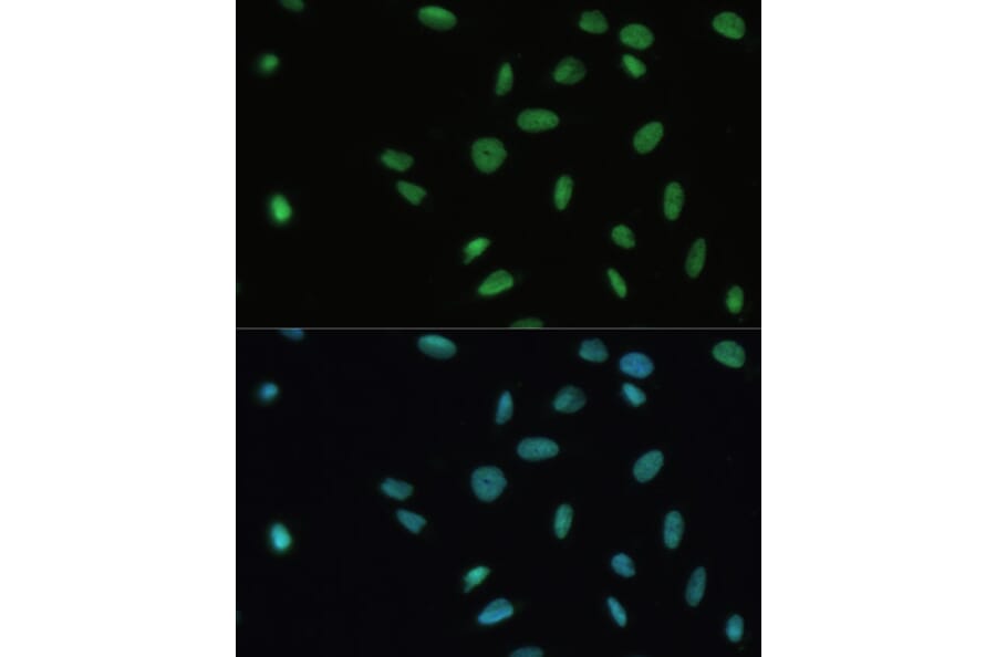 Immunofluorescence - Anti-SET/TAF-I Antibody (A15109) - Antibodies.com