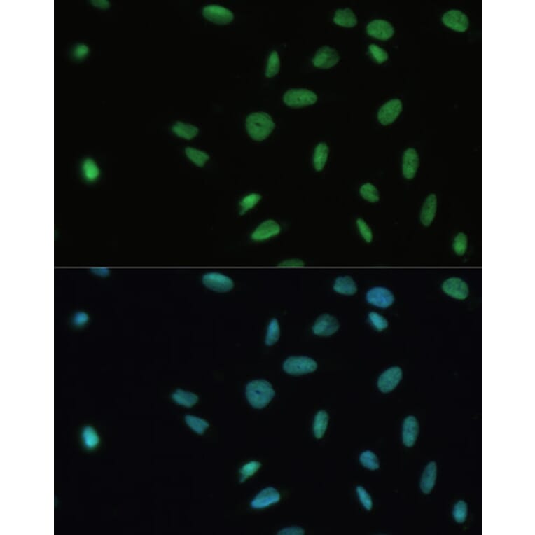Immunofluorescence - Anti-SET/TAF-I Antibody (A15109) - Antibodies.com