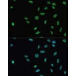 Immunofluorescence - Anti-SET/TAF-I Antibody (A15109) - Antibodies.com