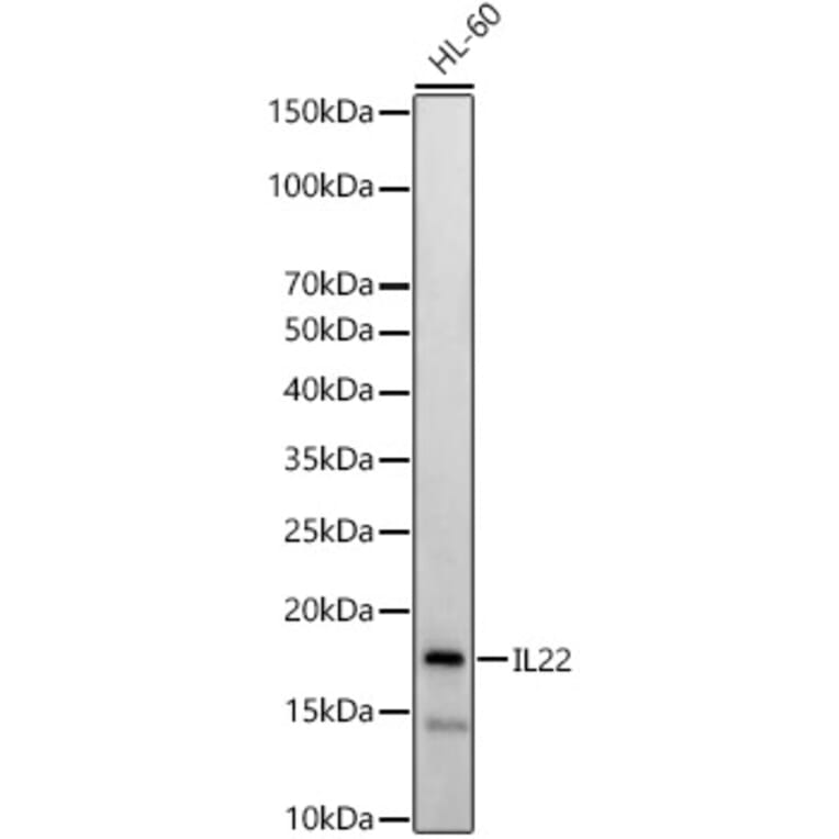Western Blot - Anti-IL-22 Antibody (A15111) - Antibodies.com