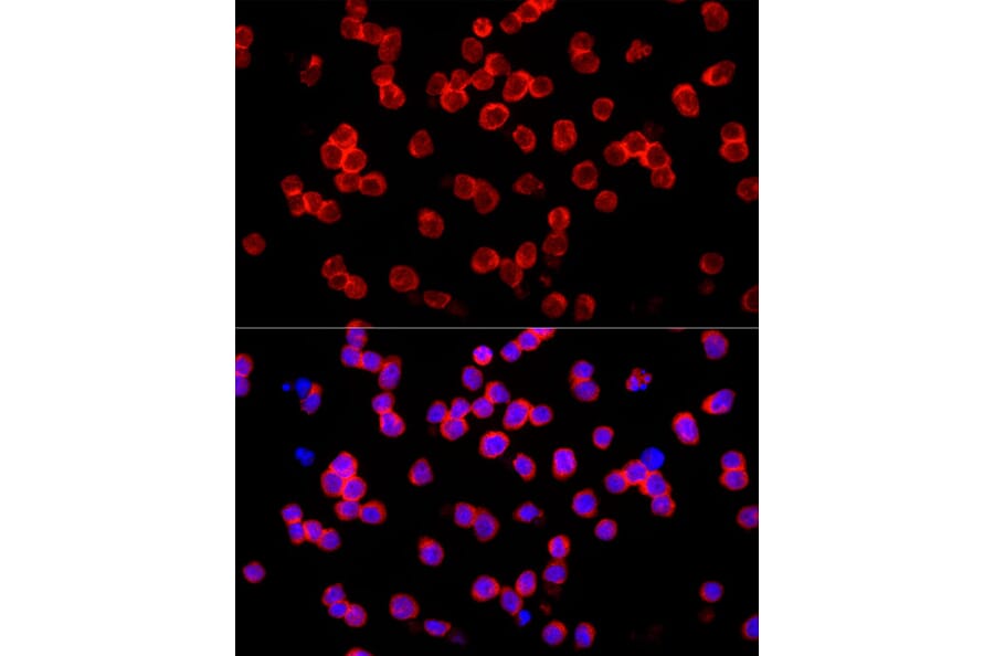 Immunofluorescence - Anti-IL-22 Antibody (A15111) - Antibodies.com