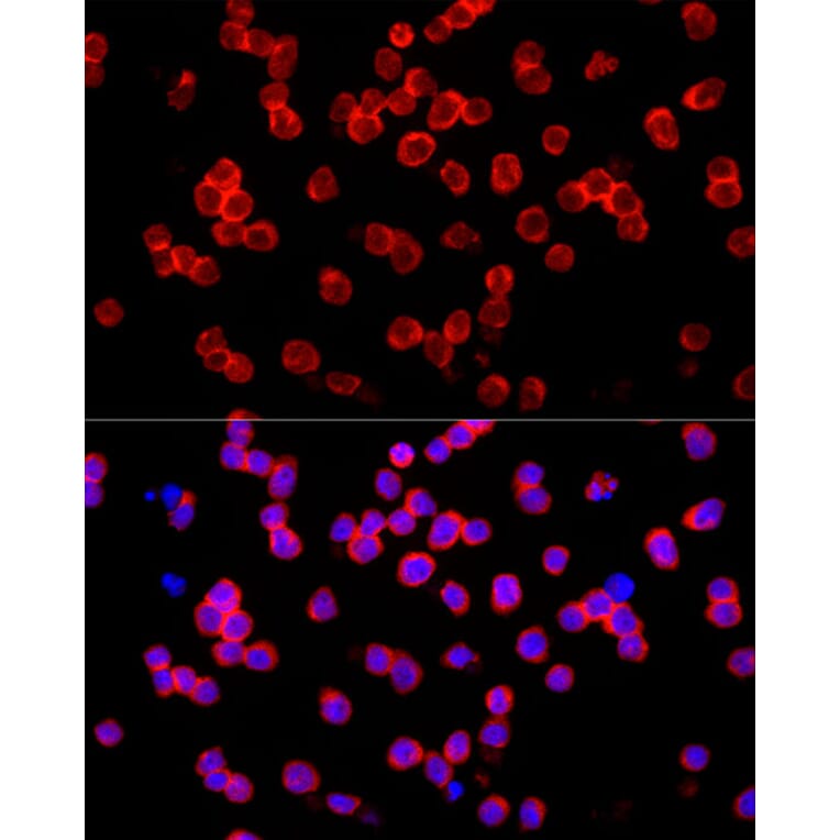 Immunofluorescence - Anti-IL-22 Antibody (A15111) - Antibodies.com