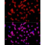 Immunofluorescence - Anti-IL-22 Antibody (A15111) - Antibodies.com