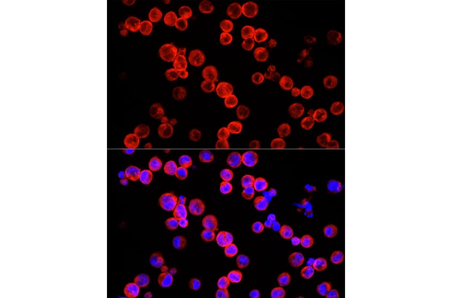 Immunofluorescence - Anti-IL-22 Antibody (A15111) - Antibodies.com