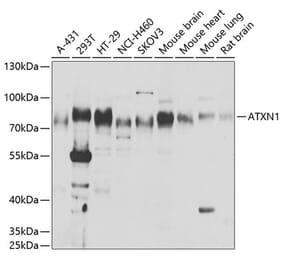 Western Blot - Anti-Ataxin 1 Antibody (A15112) - Antibodies.com
