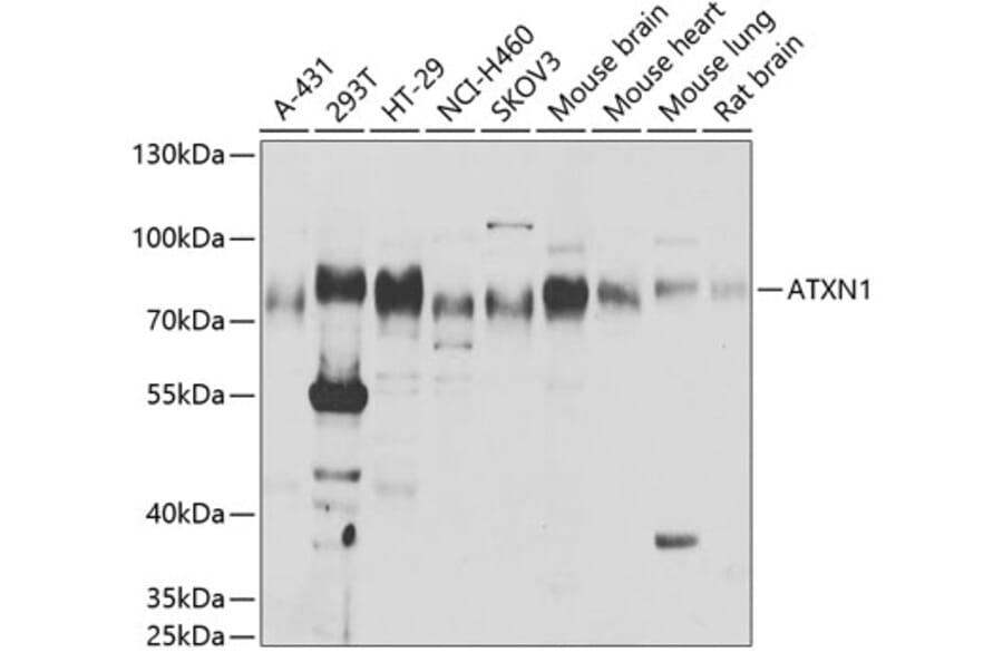 Western Blot - Anti-Ataxin 1 Antibody (A15112) - Antibodies.com