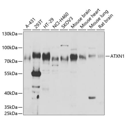 Western Blot - Anti-Ataxin 1 Antibody (A15112) - Antibodies.com