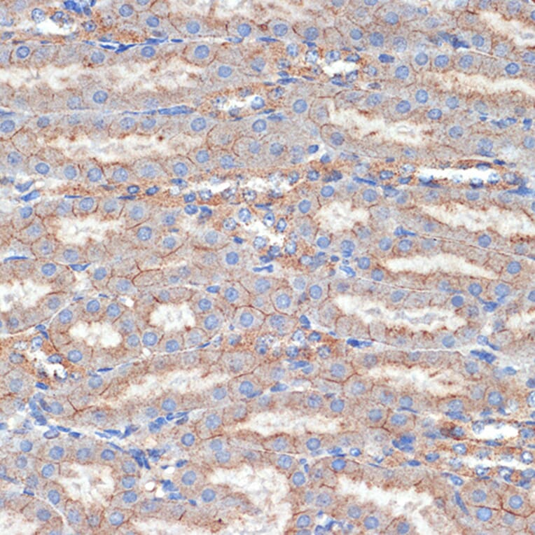 Immunohistochemistry - Anti-Flotillin 1 Antibody (A15114) - Antibodies.com