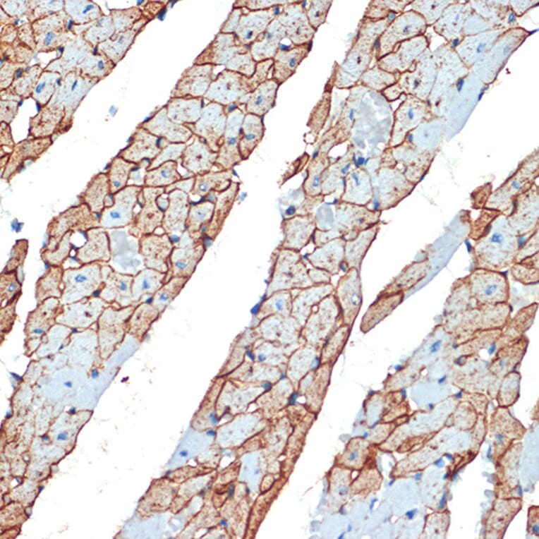 Immunohistochemistry - Anti-Flotillin 1 Antibody (A15114) - Antibodies.com
