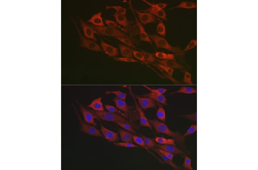 Immunofluorescence - Anti-Flotillin 1 Antibody (A15114) - Antibodies.com