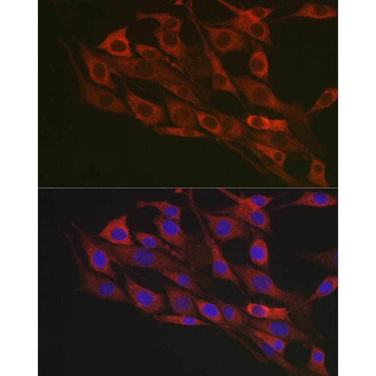 Immunofluorescence - Anti-Flotillin 1 Antibody (A15114) - Antibodies.com