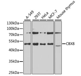 Western Blot - Anti-Cbx8 Antibody (A15115) - Antibodies.com