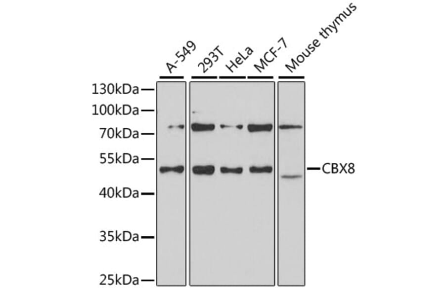 Western Blot - Anti-Cbx8 Antibody (A15115) - Antibodies.com